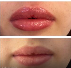 בת אל - הרצליה