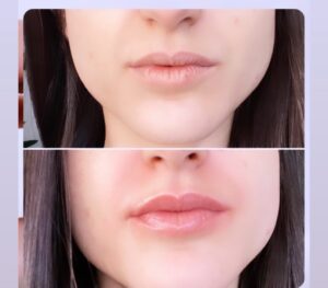 ליאורה - נהריה